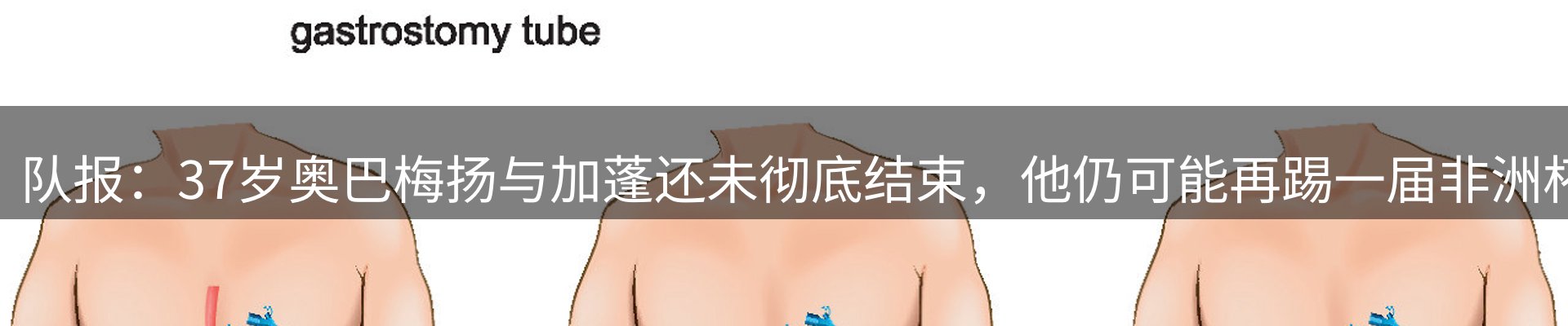 动态焦点